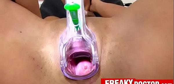  Real gyno exam of hot asian Lady Dee